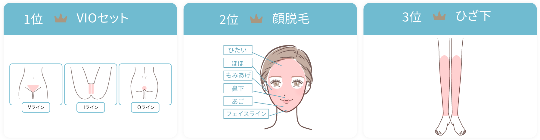 ただおかメディカルクリニック（美容皮膚科）の脱毛部位人気ランキング