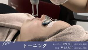 トーニング レーザー9800円(税込10,780円) ピコトーニング12,800円(税込14,080円)